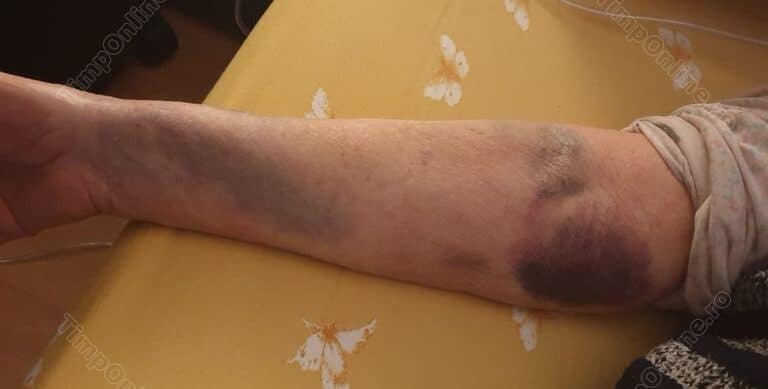 Coșmarul din spital al unei femei care s-a internat pe picioarele ei și după tratamentul anti-covid, a ieșit legumă. Acum, familia trebuie să plătească 19.000 de lei pentru tratament