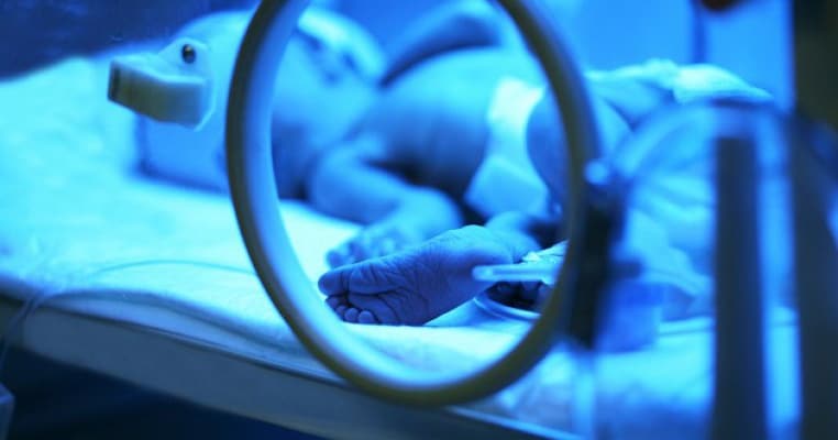 Premieră în România! Un bebeluș de o lună și jumătate a fost operat pe cord deschis