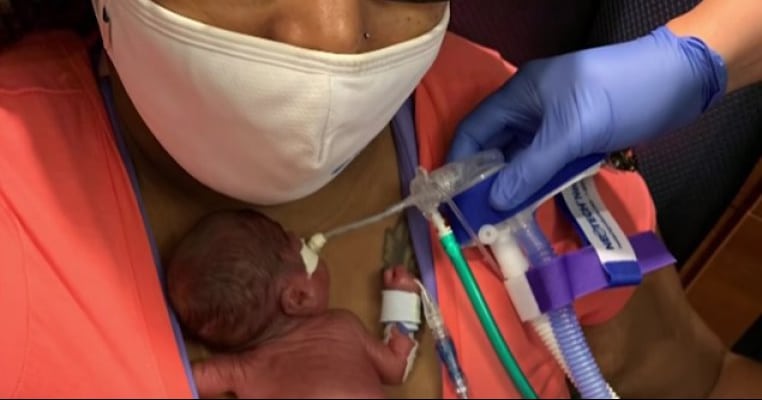 A intrat în Cartea Recordurilor! Cum arată „cel mai prematur” bebeluș din lume care a supraviețuit