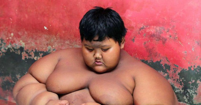 Așa arată acum cel mai gras copil din lume! Avea 192 de kilograme la numai 11 ani
